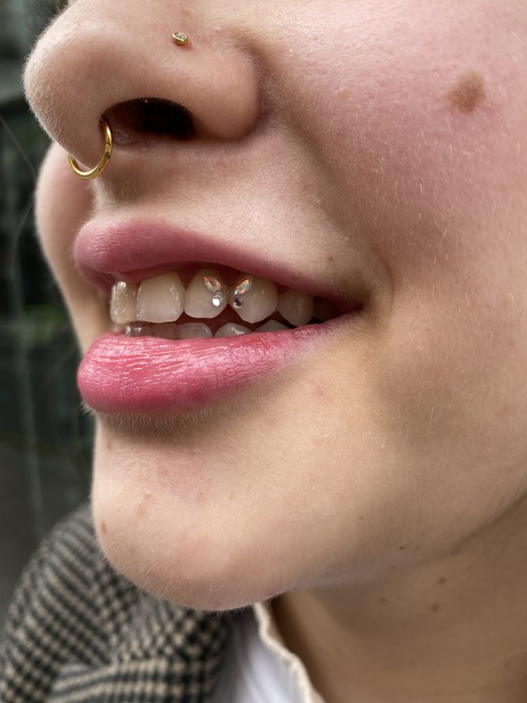 Composición de gemas dentales en forma de mariposa tooth gems con color AB